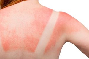 manfaat sunscreen wardah