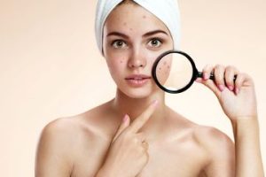 basic skincare untuk kulit berminyak dan berjerawat