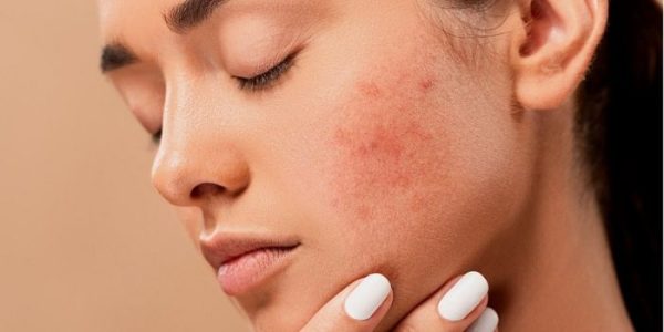 skincare cetaphil untuk kulit sensitif