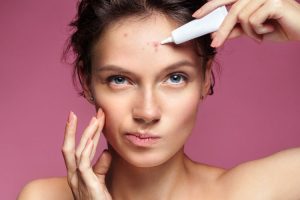 Kandungan Skincare Untuk Jerawat Dan Bruntusan