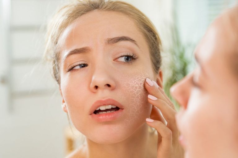 Kandungan Skincare Untuk Kulit Kering Agar Lembab Dan Sehat Kembali