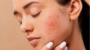 10 Skincare Aman Untuk Kulit Sensitif Terbaik Tanpa Efek Samping