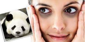cara menghilangkan mata panda