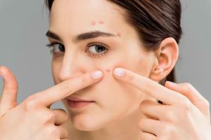 rekomendasi skincare untuk kulit berjerawat