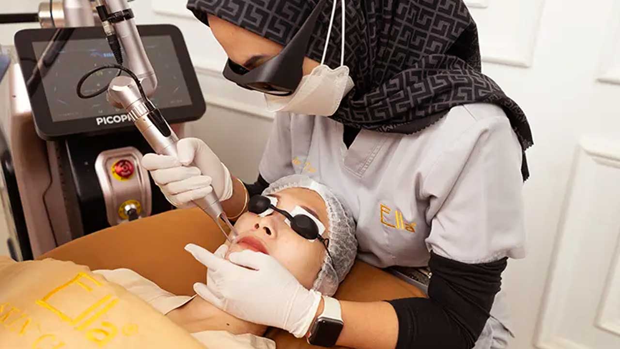 Laser Treatment di Ella Skin Care: Solusi Perawatan Kulit Modern untuk Wajah Lebih Cerah dan Sehat